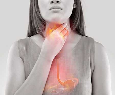 5 Dangers of Ignoring Acid Reflux