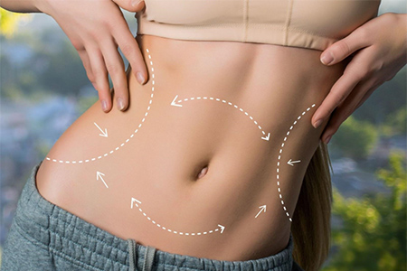 Finishing Touches: Body Contouring & Cosmetic Options After Weight Loss Surgery