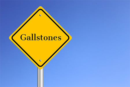 Signs and Symptoms of Gallstones