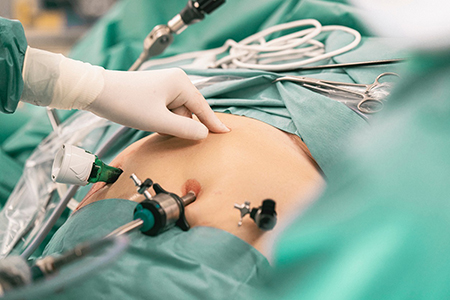 What Is Minimally Invasive Weight Loss Surgery and How Does It Help Long Island, Port Jefferson, Riverhead, Huntington Station Patients?